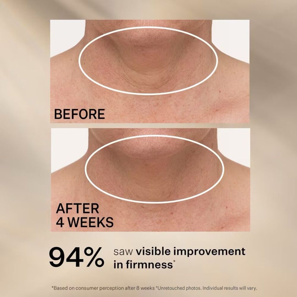 StriVectin - TL Advanced Tightening Neck Cream Plus + - $100 - Brand New! - Picture 3 of 7